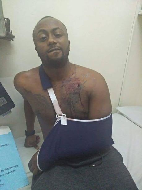 Joseph Irungu shows his bullet wound 