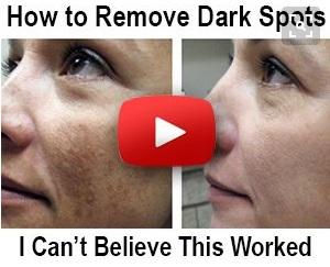  Dark-Spot-Remover