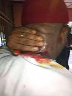 APGA Chieftain Shot During House Of Representatives Primary Election (See Photo)