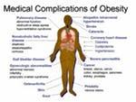 PCOS and obesity – PCOS 5