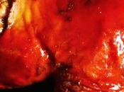 Where Most Delicious Lechon Philippines?