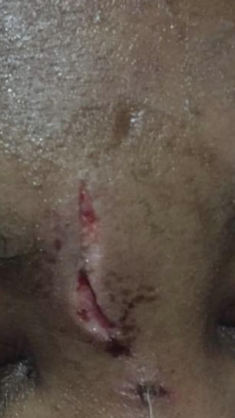 Bowen Uni Graduate @OyebanjiToluwa2 Batters His Girlfriend, Machetes her Neck (See Photos)