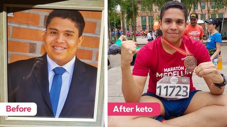 How Javier went from morbidly obese to having a new life