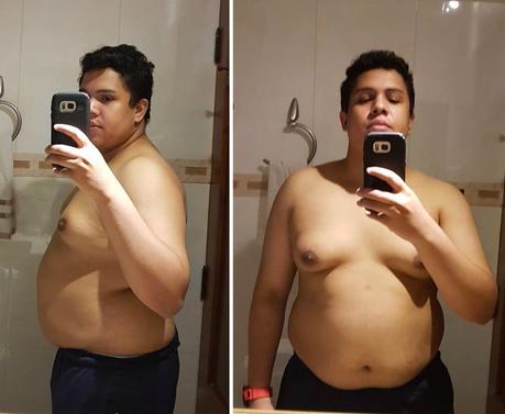 How Javier went from morbidly obese to having a new life