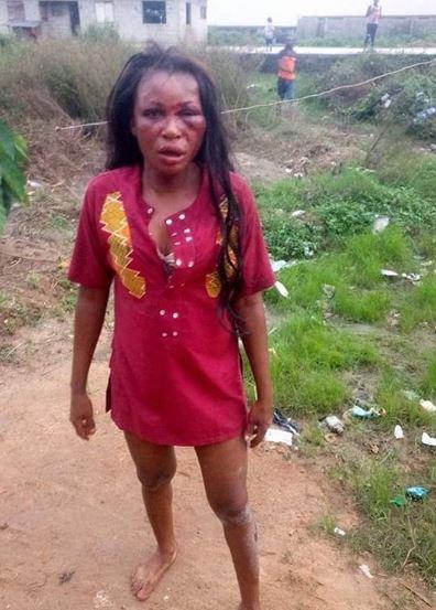 Man Batters His Wife, Scatters her Face with Blows For Crying of Hunger This Morning in PH (Photos)