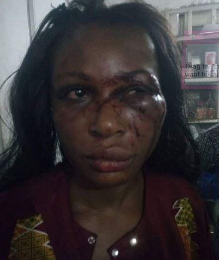 Man Batters His Wife, Scatters her Face with Blows For Crying of Hunger This Morning in PH (Photos)