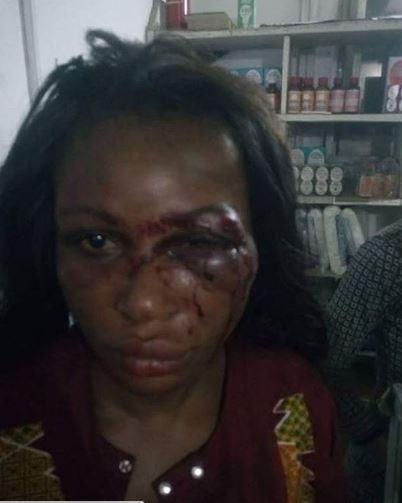 Man Batters His Wife, Scatters her Face with Blows For Crying of Hunger This Morning in PH (Photos)