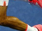 QUIZ: Name These Tennis Players Their Legs?