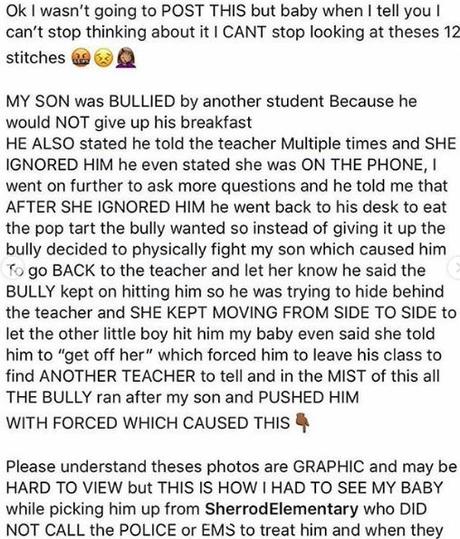 Little Boy Brutally Injured by his Classmate For Refusing to Share His Breakfast With him (Graphic Photos)