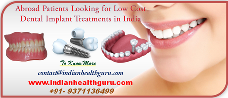 Abroad Patients Looking for Low-Cost Dental Implant Treatments in India