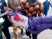 Security Operatives Allegedly Open Fire Shiite Muslims Abuja (Graphic Photos)