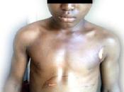 Woman Burns 12year Houseboy with Iron Drinking Mineral (Photos)