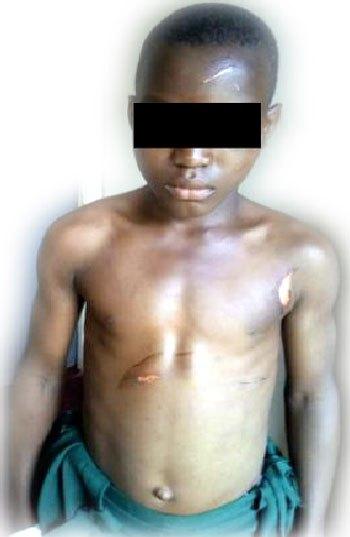 Woman Burns her 12year Old Houseboy with Hot Iron For Drinking her Mineral in Imo (Photos)