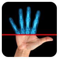 Best X Ray Apps Android 