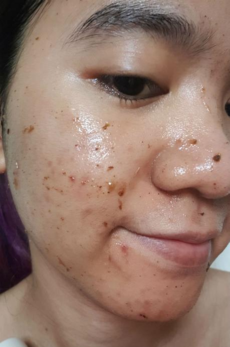 Keep Your Acne & Pimples at Bay: I’m From Mugwort Mask Review