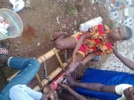 Student Breaks His Leg After Classroom Collapsed During Lectures (Photos)