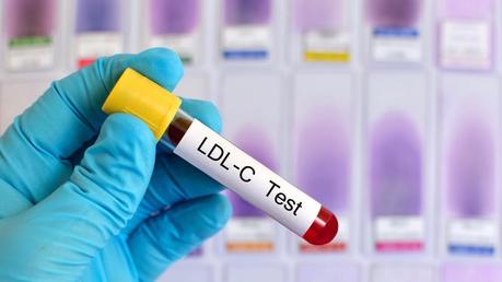 High LDL cholesterol may protect against dementia – don’t tell the statin pushers!