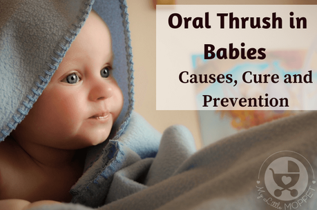 Oral Thrush in Babies – Causes, Cure and Prevention - Paperblog