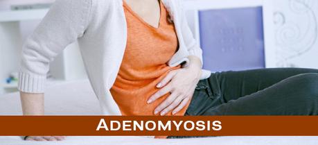 How to Get Rid of Adenomyosis with Natural Remedies ?