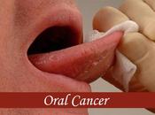 Treat Oral Cancer with Home Remedies