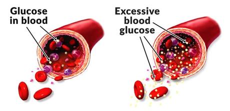 A Wonderful Remedy To Avoid And Treat Diabetes Without Medication?