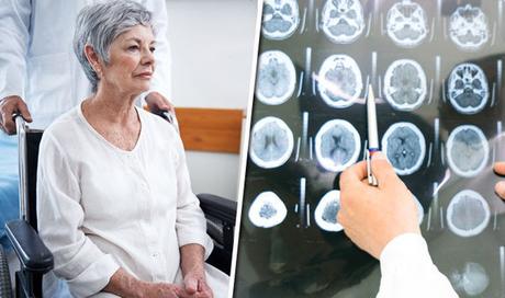 What is the best treatment for Alzheimer’s Disease?