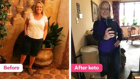 Can a keto diet help with severe gut issues?