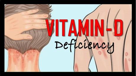 What are the Signs and Symptoms of Vitamin D Deficiency?