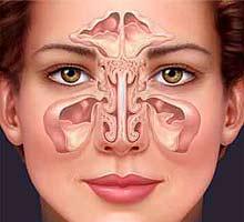 Natural Health Remedies for Sinusitis