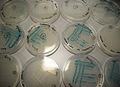 E. coli Detective Work Produces No Answers