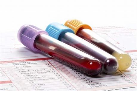 How You Can Use a Site Like Cleardrugtests.com to Pass Drug Tests
