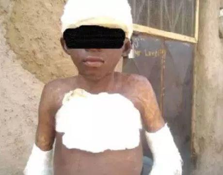 Man Sets 11-year-old Boy On Fire For Allegedly Peeping At A Woman In A Bathroom (Photo)