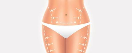 Know How To Treat Genetic Fat - Liposuction | Dr. Gaurav Garg