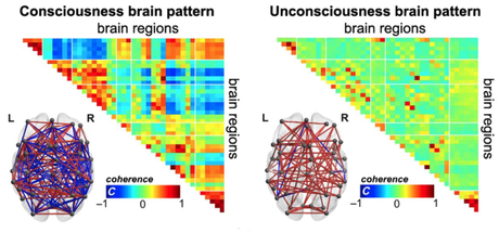 Brain patterns of consciousness