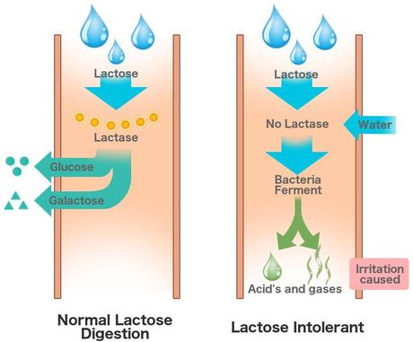 Lactose Intolerance – How do you know you have it? Lactose Intolerance – How do you know you have it?
