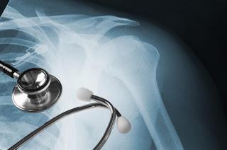 Bone Dislocation, Orthopedists in Kolkata