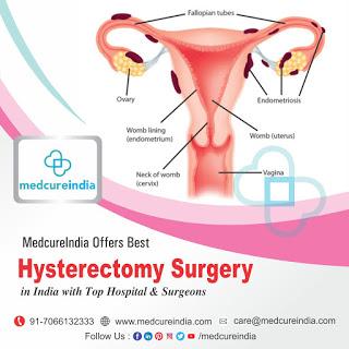 Hysterectomy – Beneficial OR Detrimental