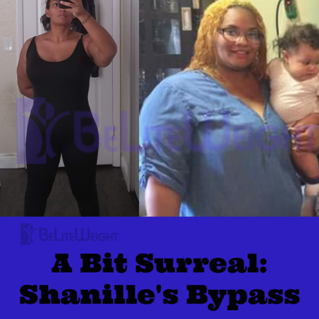 A Bit Surreal: Shanille’s Bypass