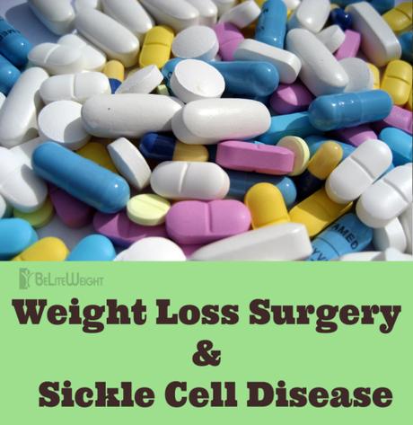 Weight Loss Surgery and Sickle Cell Disease