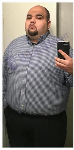 Jose’s Gastric Sleeve: Life Changing