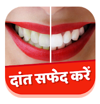 Teeth whitening apps Android 