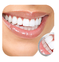 Teeth whitening apps Android 