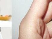 What Main Reason White discharge?-You Must Know