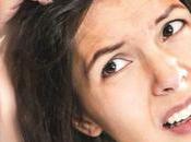 Dandruff Using Home Remedies?