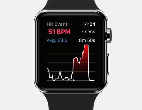 6 Best Heart Rate Monitors for Apple Watch