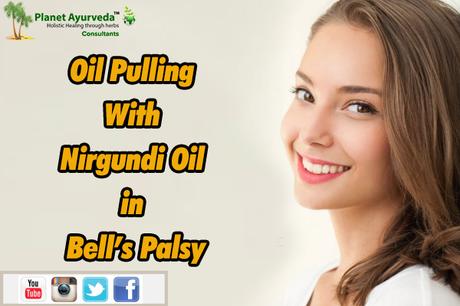 Oil Pulling With Nirgundi Oil in Bell’s Palsy