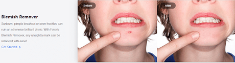 Online Photo Editor Fotor | Take Your Photos And Designing To Next Level removes photo blemishes,online photo editor