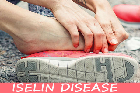 How Iselin Disease Can Be Cured with The Help of Ayurevda? How Iselin Disease Can Be Cured?