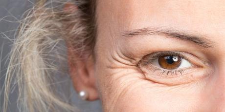 Wrinkles Prevention & Treatment