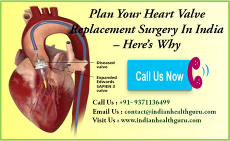 Plan Your Heart Valve Replacement Surgery In India – Here’s Why